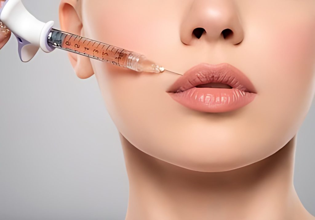 Lip Flip Treatment - £60